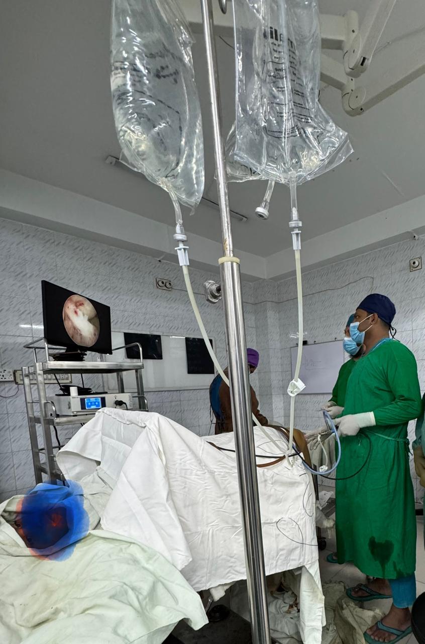 During Arthroscopic ACL Reconstruction in Rajshahi